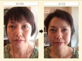 エステでこんなにリフトアップしたの初めてです。