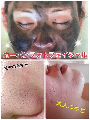 ラジオのお話！「夏のダメージケア」