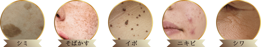 フラッシュプラズマシミ取り